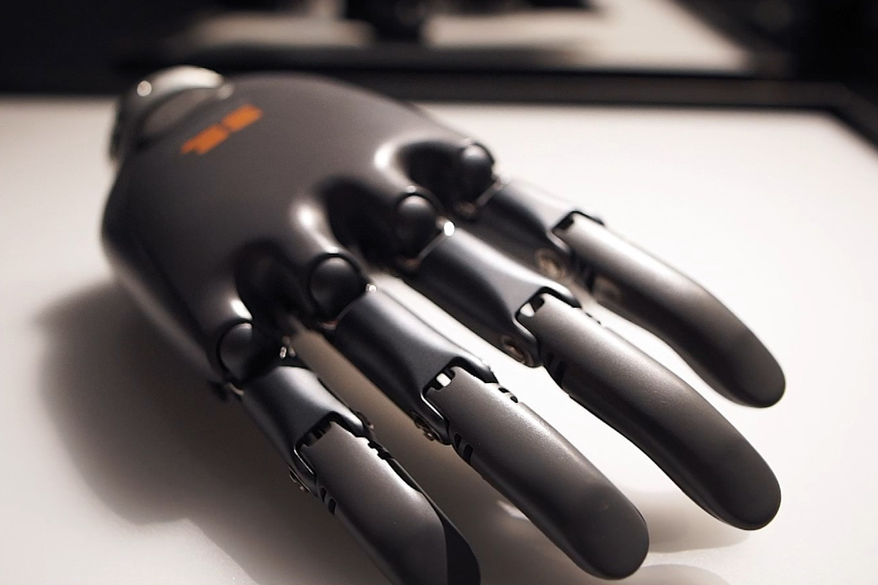 The AI hand prosthesis 